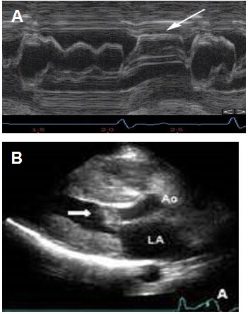 Imaging in Hypertrophic Cardiomyopathy - American College of Cardiology